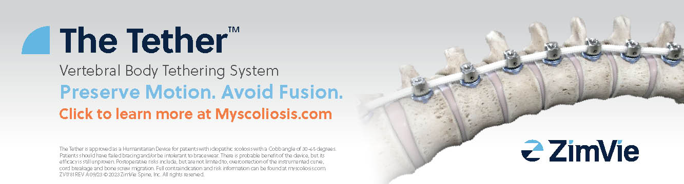 ZimVie Ad For Vertebral Body Tethering System