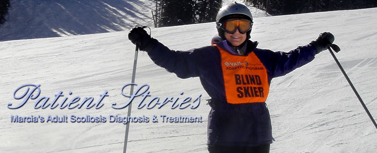 Female Skiing with text on image - Patient Stories Marcia's Adult Scoliosis Diagnosis & Treatment